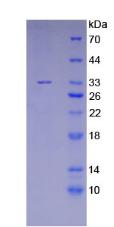 Recombinant Meningioma Expressed Antigen 5 (MGEA5)