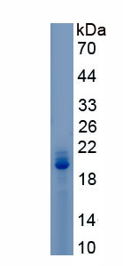 Recombinant Meningioma Expressed Antigen 5 (MGEA5)