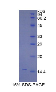 Recombinant Meningioma Expressed Antigen 5 (MGEA5)