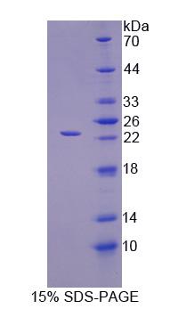 Recombinant Interleukin 1 Alpha (IL1a)