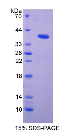 Recombinant Defensin Beta 2 (DEFb2)