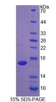 Recombinant Interleukin 2 (IL2)