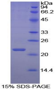 Recombinant Interleukin 2 (IL2)