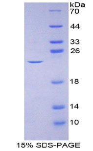 Recombinant Interleukin 2 (IL2)