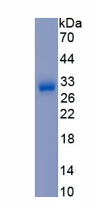 Recombinant Interleukin 5 (IL5)