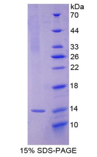 Recombinant Interleukin 8 (IL8)