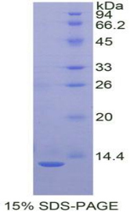 Recombinant Interleukin 8 (IL8)