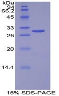 Recombinant Leptin Receptor (LEPR)