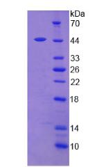 RPA084Hu01.jpg