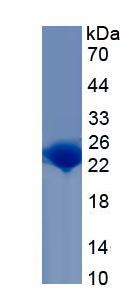 Recombinant Leptin (LEP)