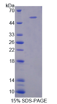 Recombinant Selectin, Leukocyte (SELL)