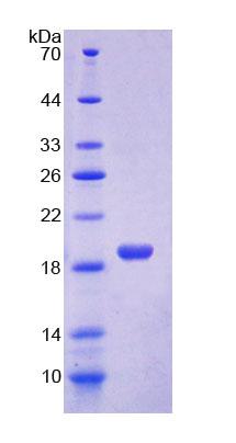 Recombinant Monocyte Chemotactic Protein 1 (MCP1)