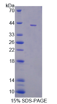 Recombinant Monocyte Chemotactic Protein 2 (MCP2)