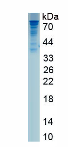 Recombinant Colony Stimulating Factor 1, Macrophage (MCSF)