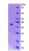 Recombinant Colony Stimulating Factor 1, Macrophage (MCSF)