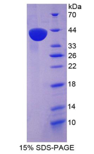 Recombinant Macrophage Inflammatory Protein 1 Alpha (MIP1a)