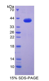 Recombinant Macrophage Inflammatory Protein 1 Alpha (MIP1a)