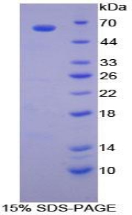 Recombinant Macrophage Inflammatory Protein 1 Beta (MIP1b)