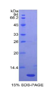 Recombinant Macrophage Inflammatory Protein 1 Beta (MIP1b)