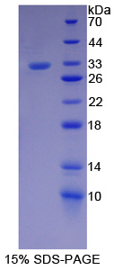 RPA094Hu01.jpg