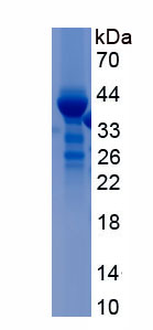 Recombinant Macrophage Inflammatory Protein 3 Alpha (MIP3a)