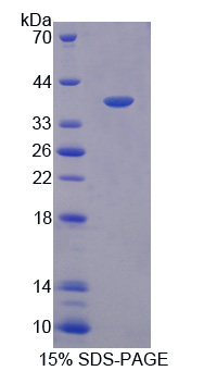 Recombinant Macrophage Inflammatory Protein 3 Beta (MIP3b)