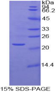 Recombinant Matrix Metalloproteinase 1 (MMP1)