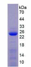 Recombinant Matrix Metalloproteinase 1 (MMP1)