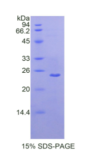 RPA099Hu02.jpg