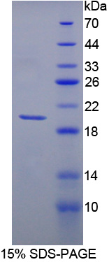 Recombinant Matrix Metalloproteinase 13 (MMP13)