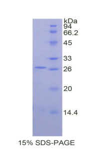 Recombinant Matrix Metalloproteinase 2 (MMP2)