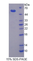 Recombinant Matrix Metalloproteinase 3 (MMP3)