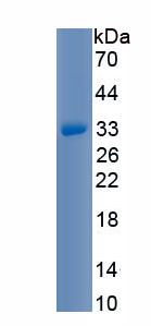 Recombinant Matrix Metalloproteinase 7 (MMP7)