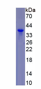 Recombinant Matrix Metalloproteinase 8 (MMP8)