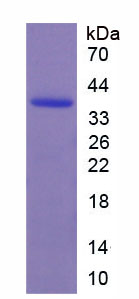 Recombinant Matrix Metalloproteinase 8 (MMP8)