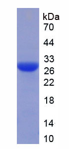 Recombinant Nerve Growth Factor (NGF)