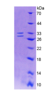 Recombinant Nerve Growth Factor (NGF)
