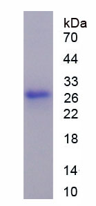 Recombinant Nerve Growth Factor (NGF)