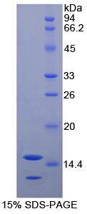 RPA106Hu01.jpg