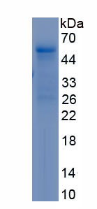 Recombinant Osteoprotegerin (OPG)