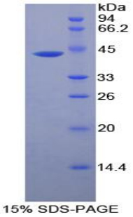 Recombinant Creatine Kinase, Muscle (CKM)