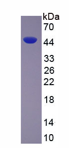 Recombinant Creatine Kinase, Muscle (CKM)