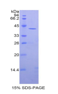 Recombinant Creatine Kinase, Muscle (CKM)