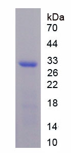 Recombinant Ribonuclease T2 (RNASET2)