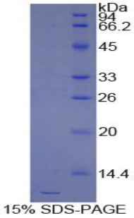 Recombinant Regulated On Activation In Normal T-Cell Expressed And Secreted (RANTES)