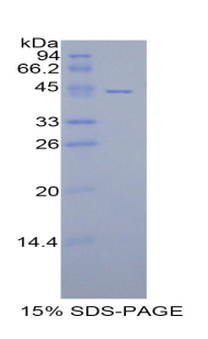 Recombinant Cluster Of Differentiation 40 Ligand (CD40L)