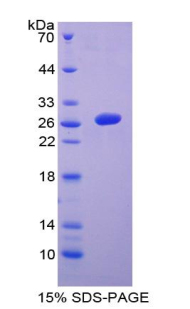 Recombinant Stem Cell Factor Receptor (SCFR)