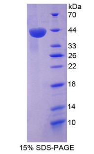 RPA122Hu02.jpg