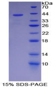 Recombinant Stromal Cell Derived Factor 1 (SDF1)