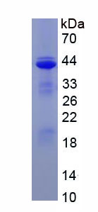 RPA124Hu02.jpg